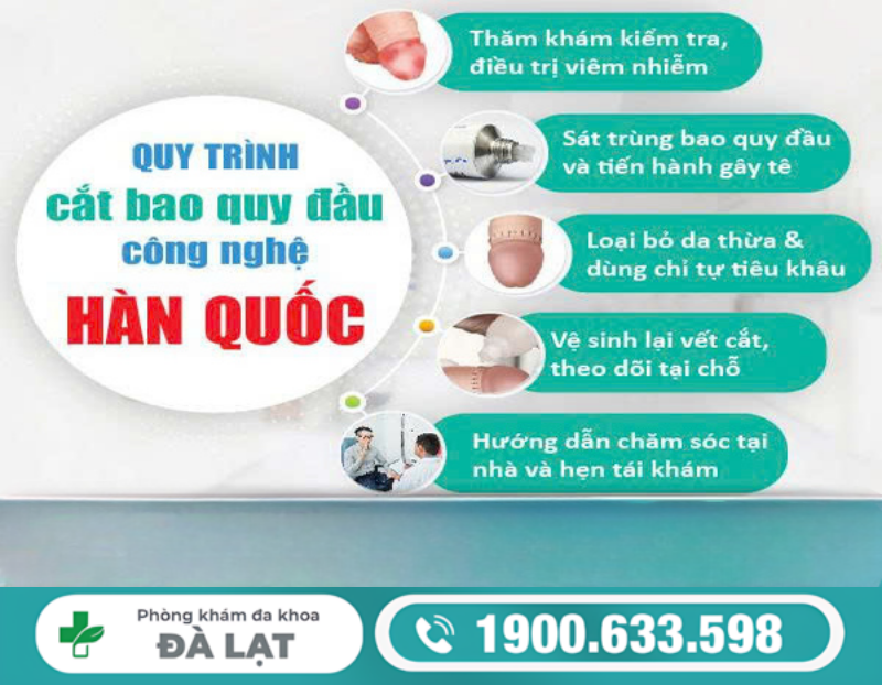 Hình ảnh minh họa